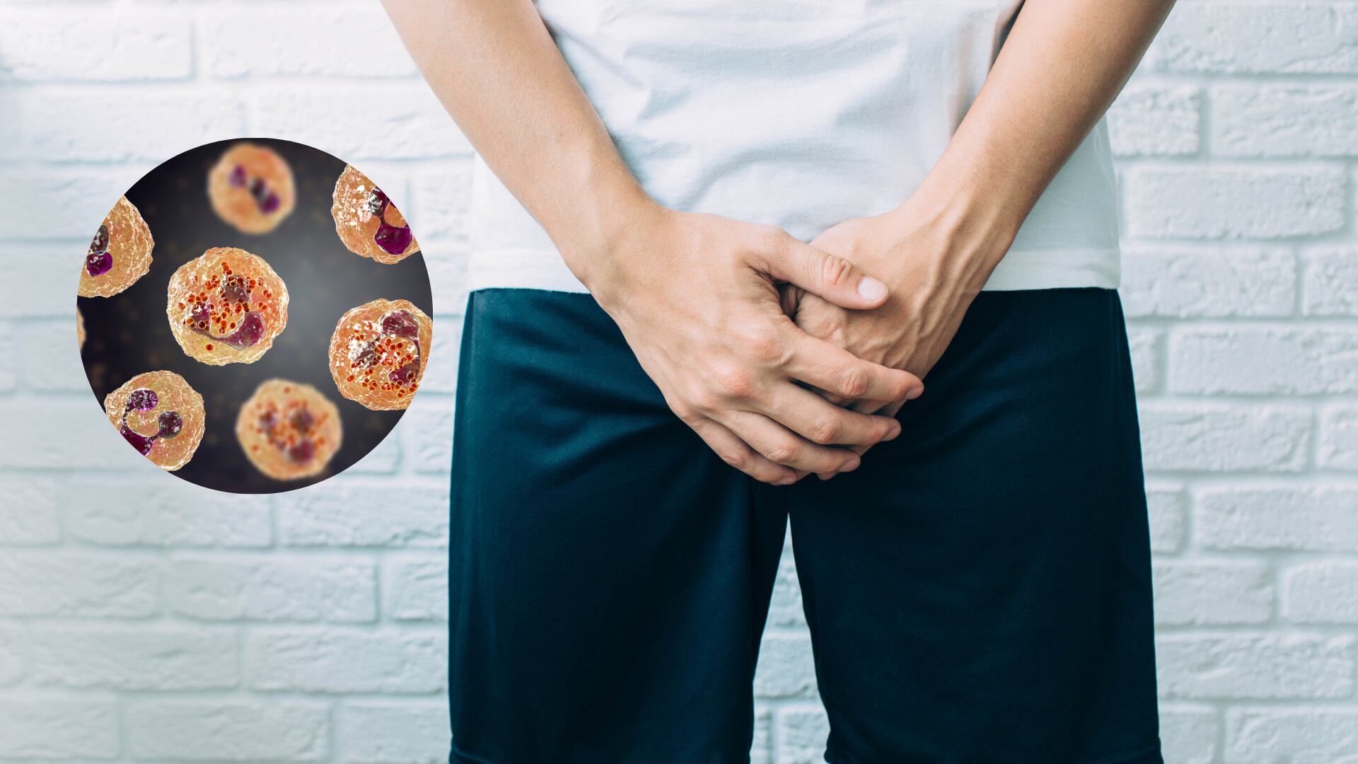 Gonorrea - Getty Images