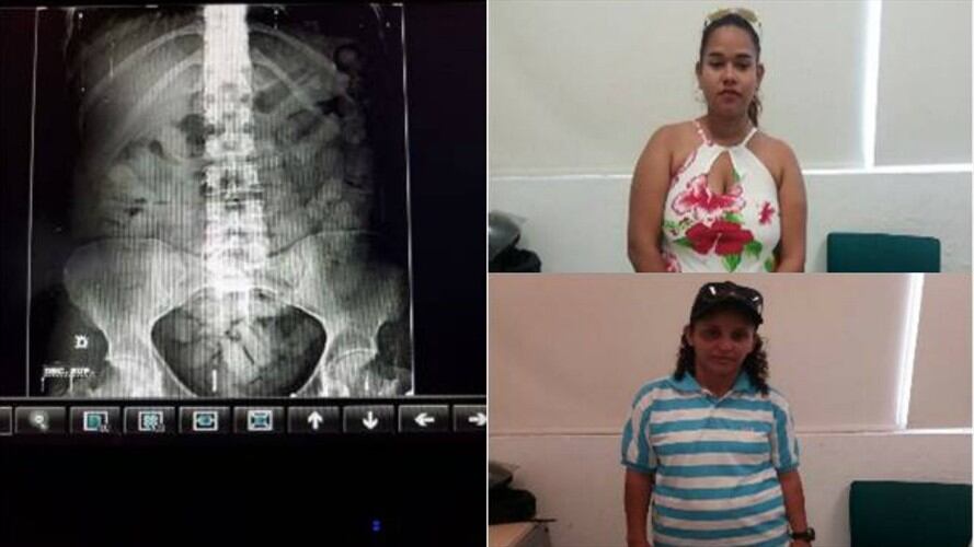 En total, las mujeres capturadas llevaban 2.650 gramos de droga. Foto: Policía Antinarcóticos
