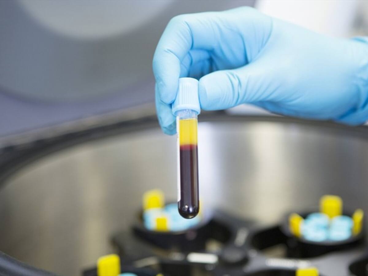 ¿La cura para el coronavirus podría estar en los pacientes que ya se infectaron?