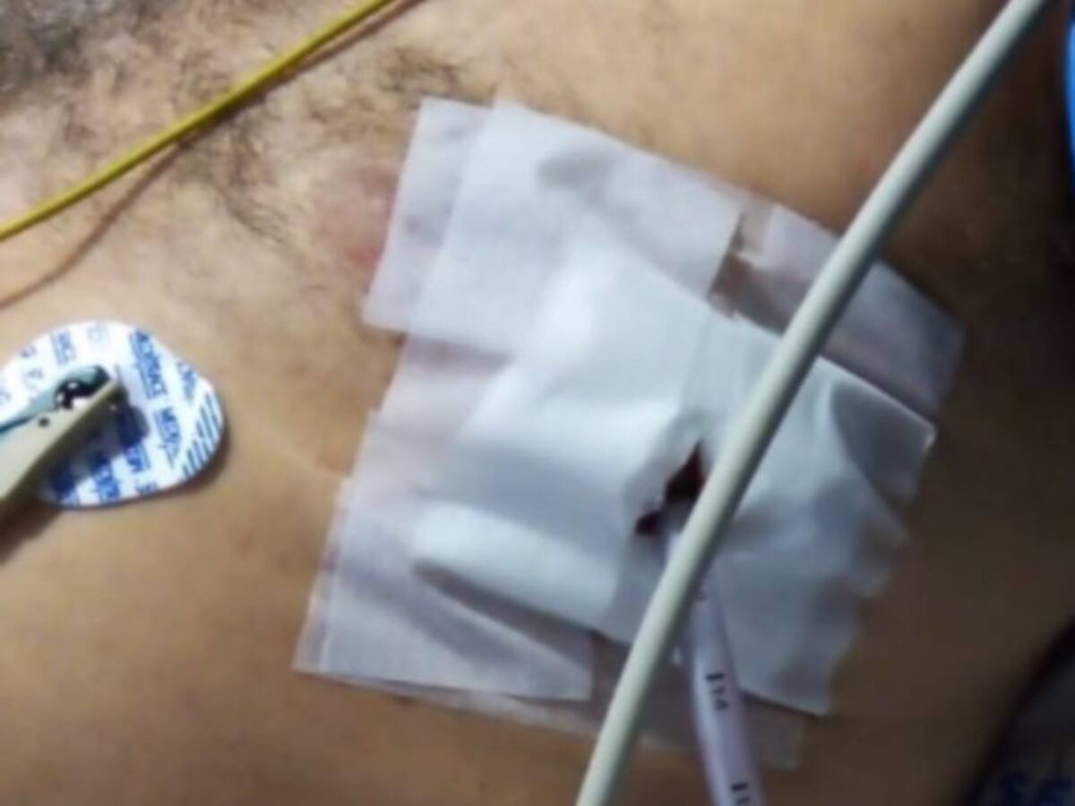 Taxista en Manizales está en UCI por pelear con un policía