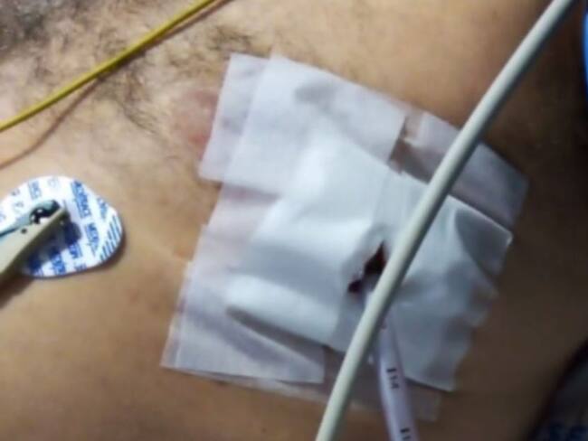 herida con arma cortopunzante