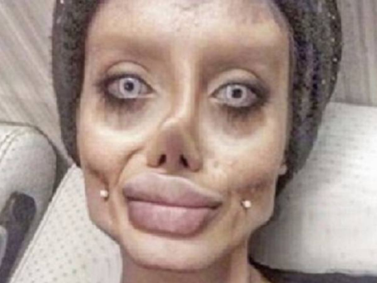 Joven Iraní se sometió a 50 cirugías para parecerse a Angelina Jolie