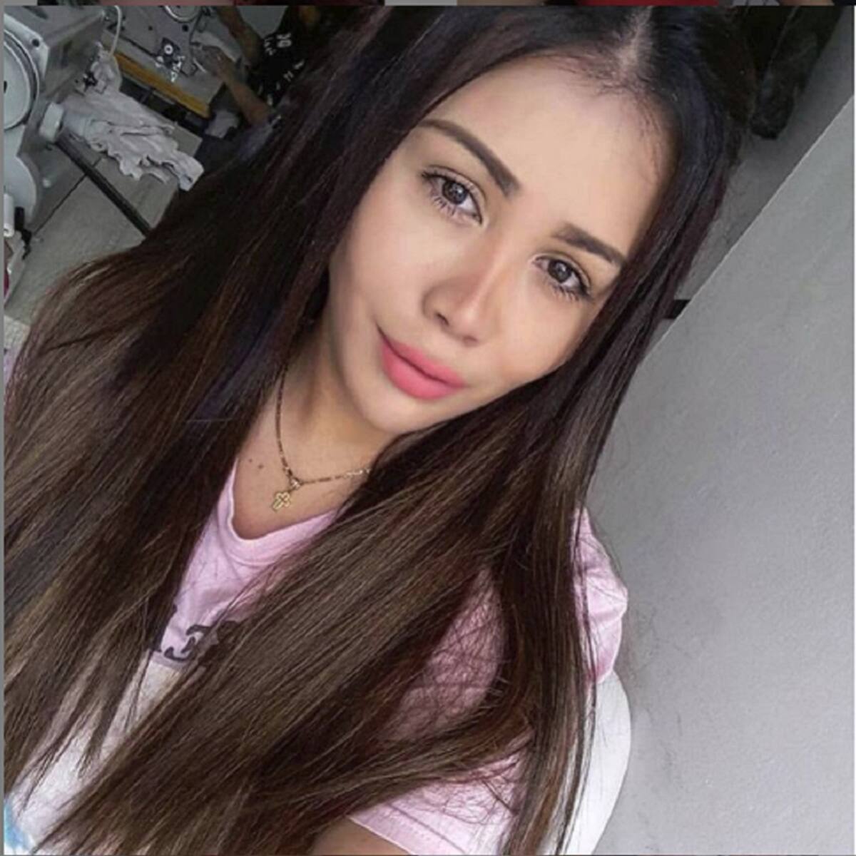 ¡Otra cirugía! Yina Calderón muestra su nueva cara
