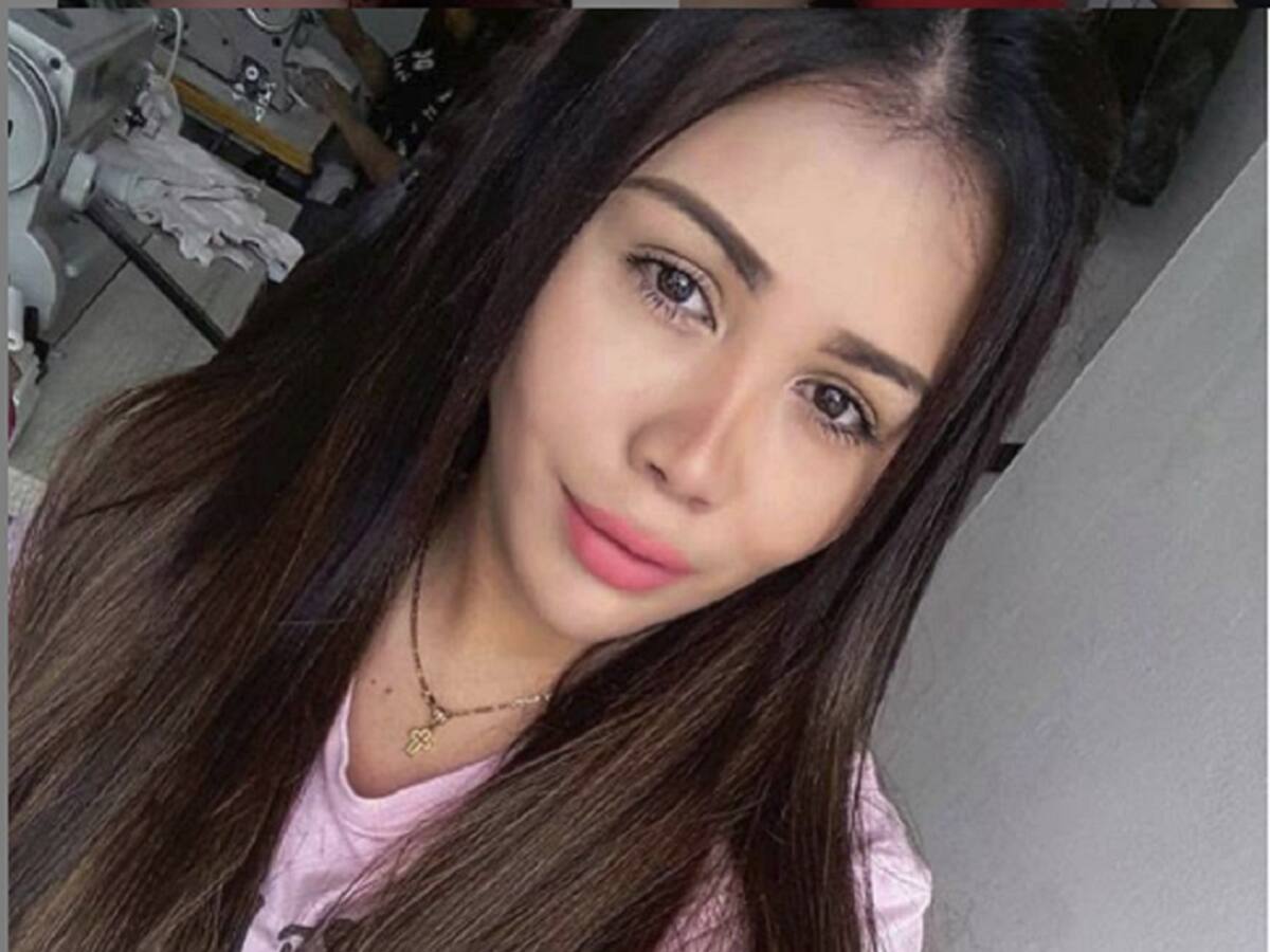 ¡Otra cirugía! Yina Calderón muestra su nueva cara