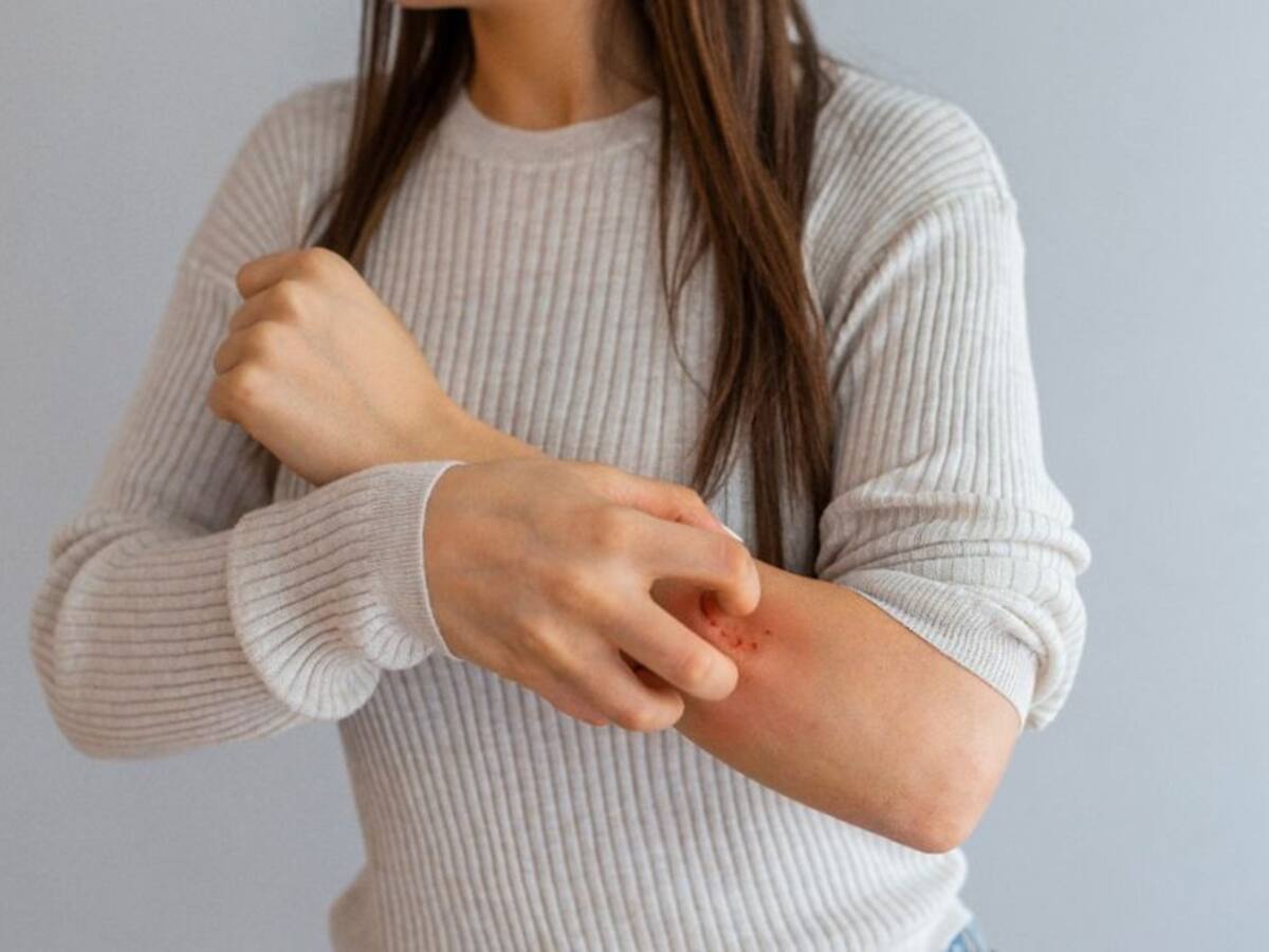 Prevención de la dermatitis