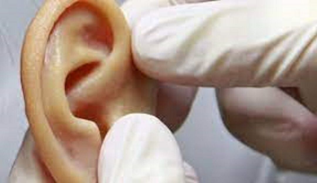 ¡Asombroso! Logran transplantar una oreja en 3D hecha con células humanas