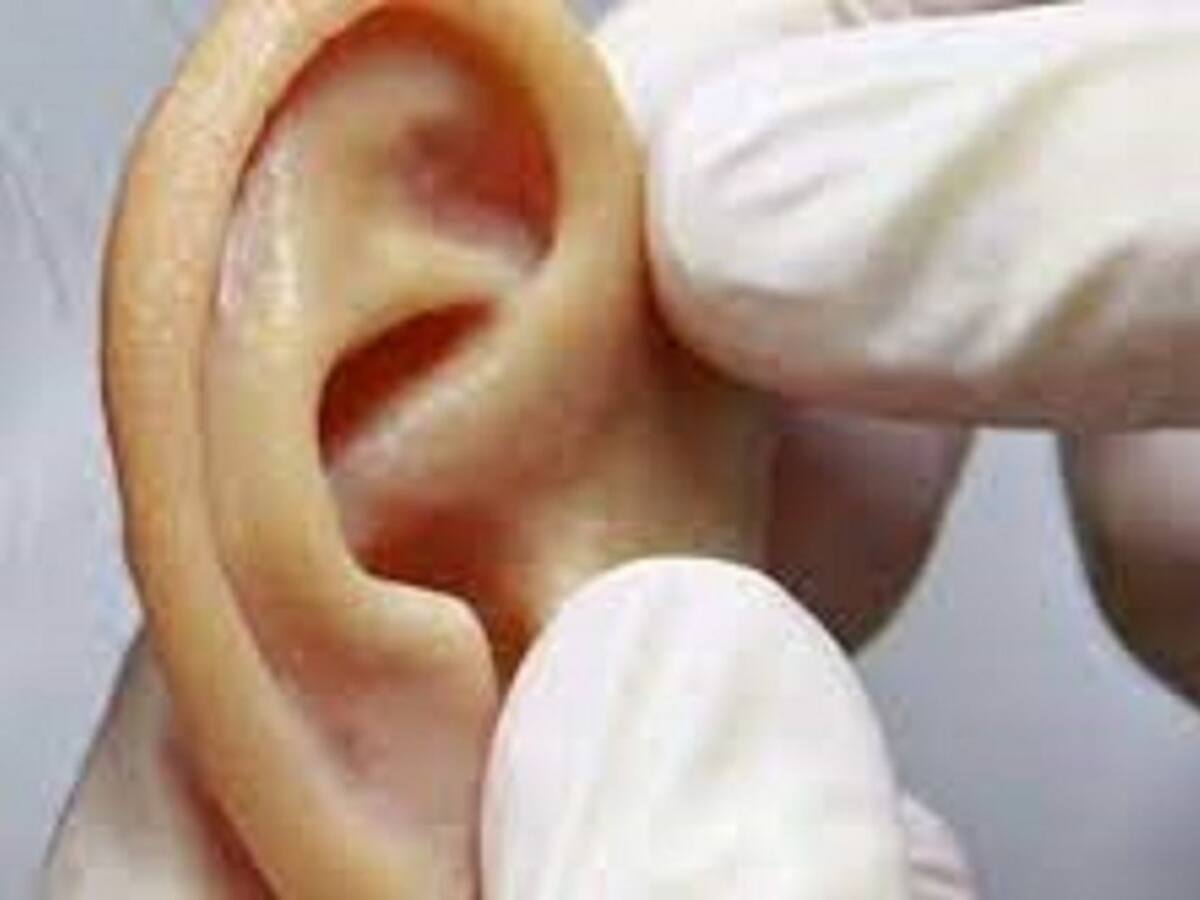 ¡Asombroso! Logran transplantar una oreja en 3D hecha con células humanas