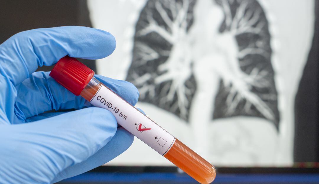 Nueva cepa del COVID-19