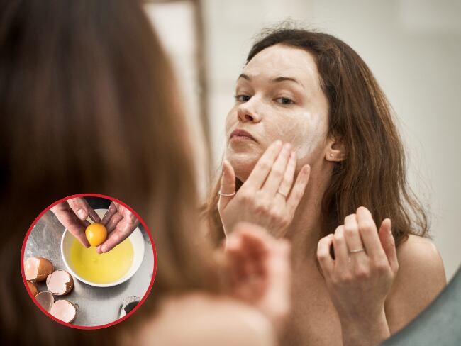 Tratamiento de huevo en la cara/ Imagen de referencia/ Getty Images