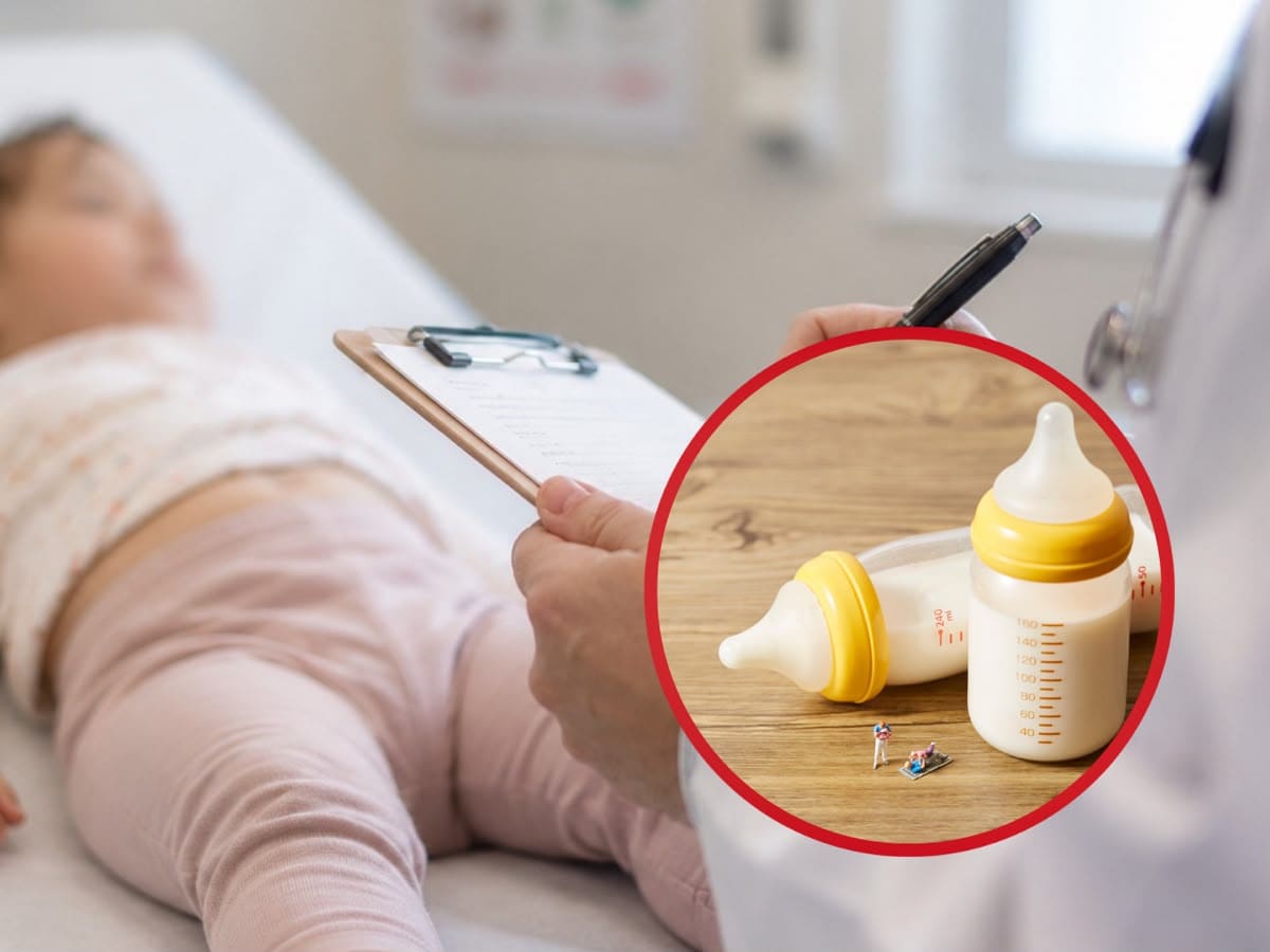 Alertan por dificultades en acceso a tratamientos para niños con alergia a la leche