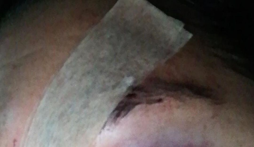 Foto cortesía. Mujer agredida en Manizales.