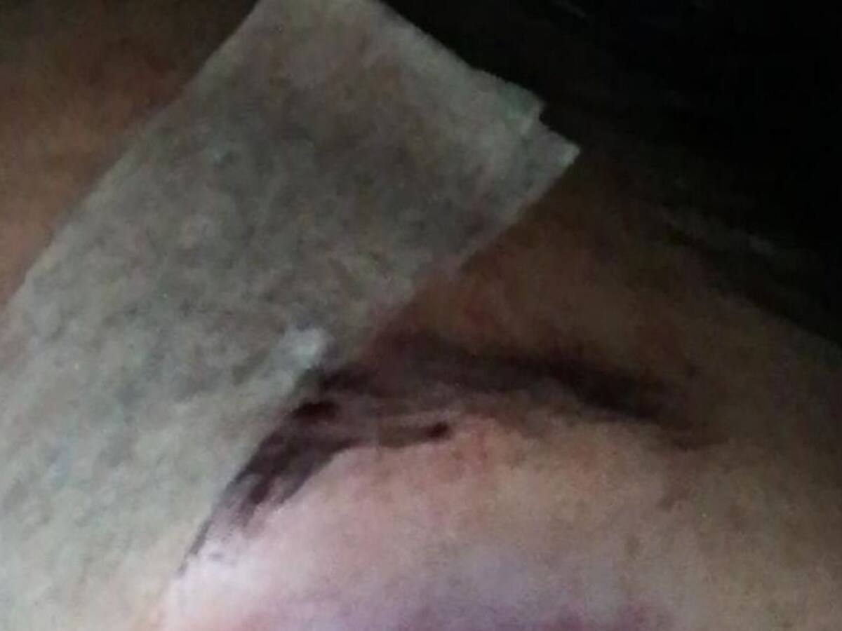 Una mujer fue brutalmente golpeada por un inquilino en Manizales