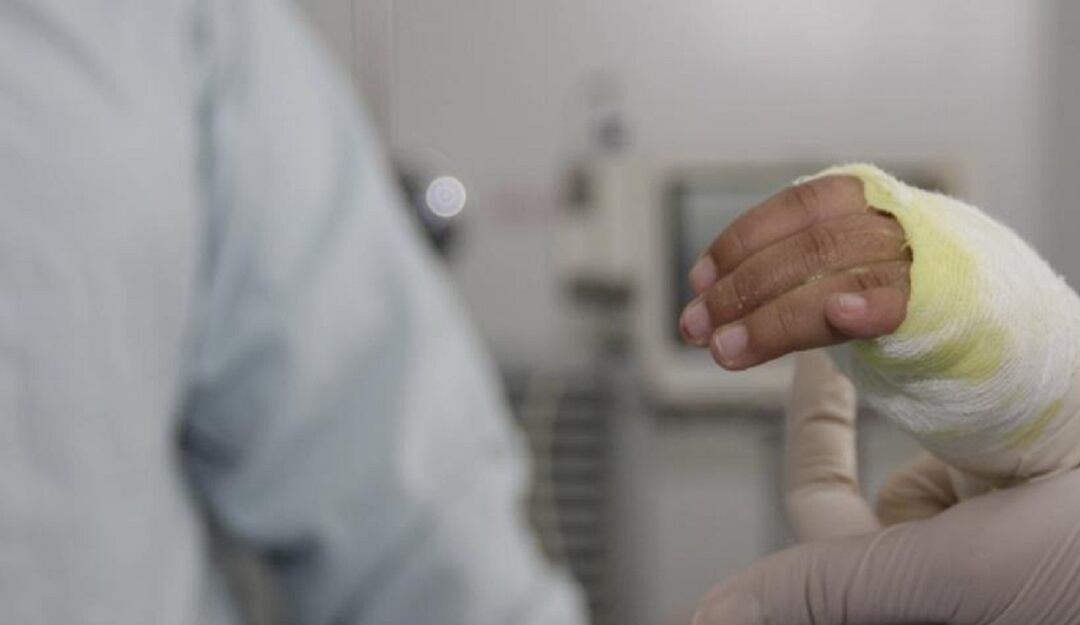 Quemados con pólvora