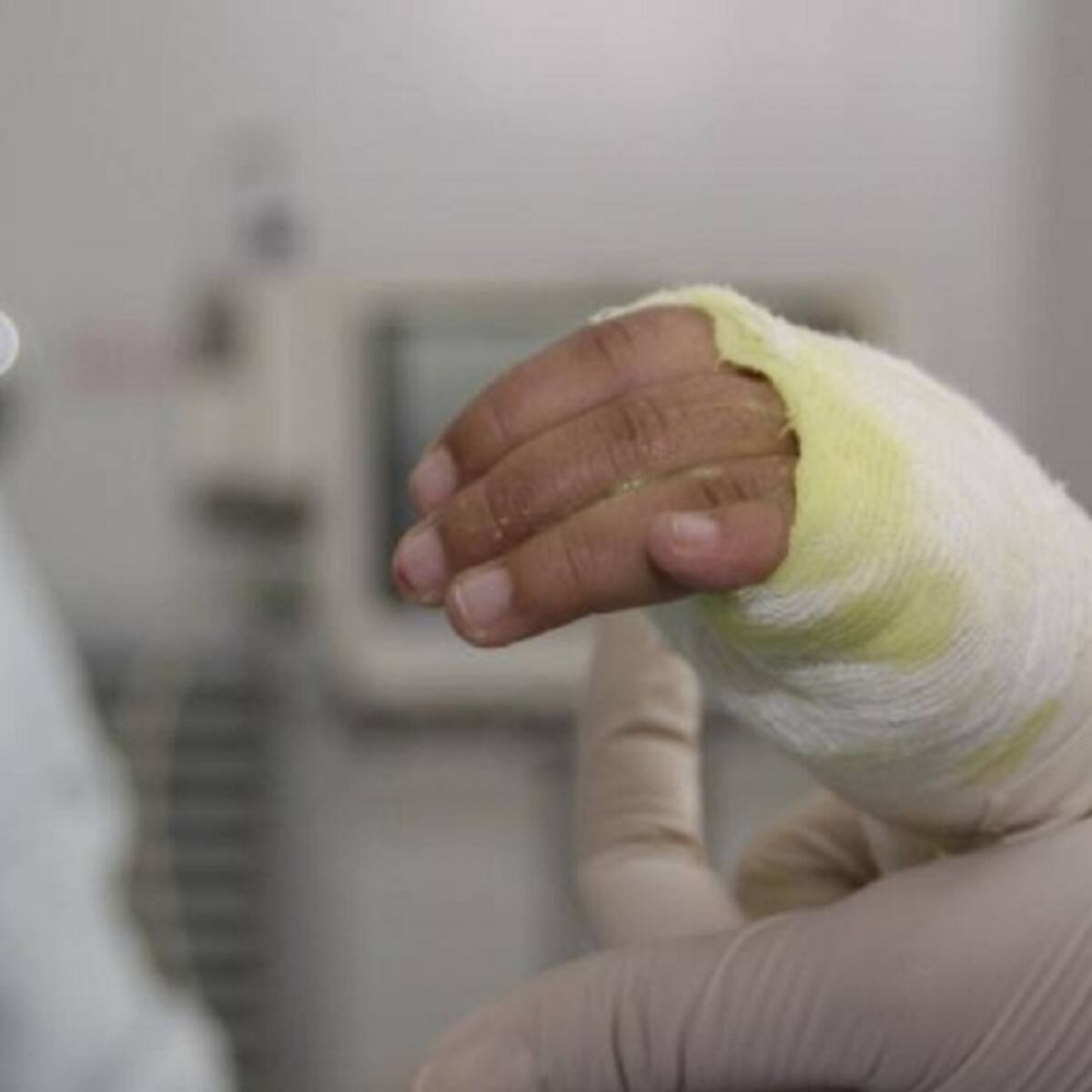 Nuevo reporte del estado de salud de los niños heridos en explosión