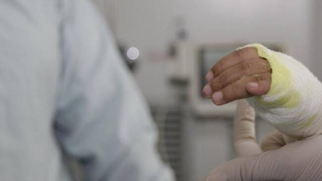 Quemados con pólvora