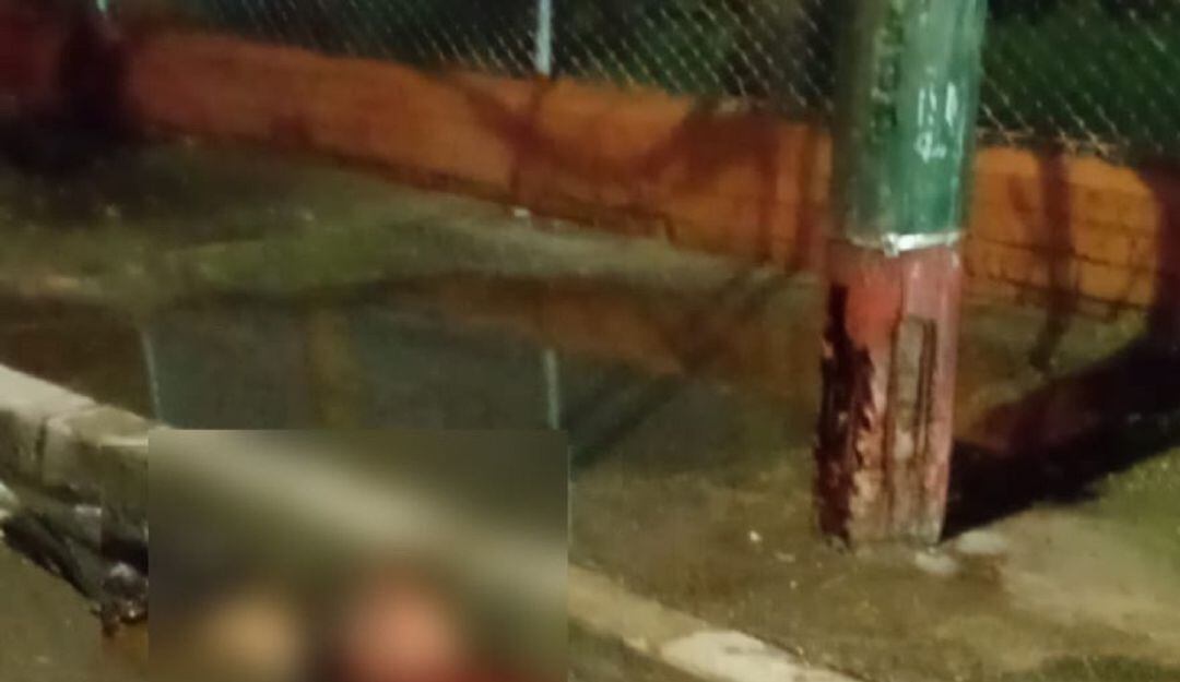 Encuentran una cabeza humana al nororiente de Cali