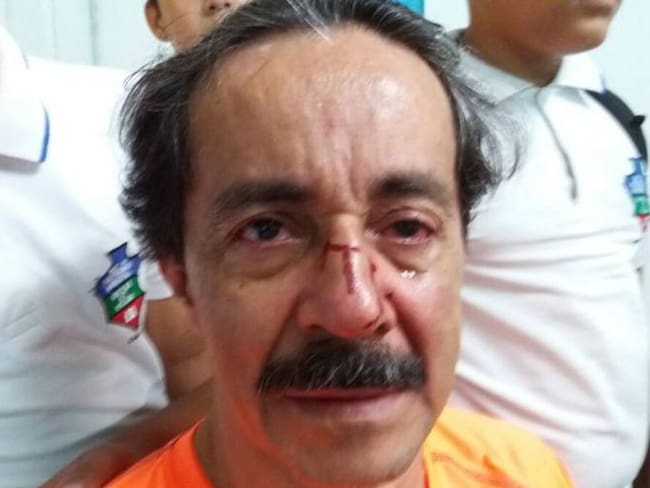 Profesor del Politécnico fue atacado a puños y patadas frente a estudiantes