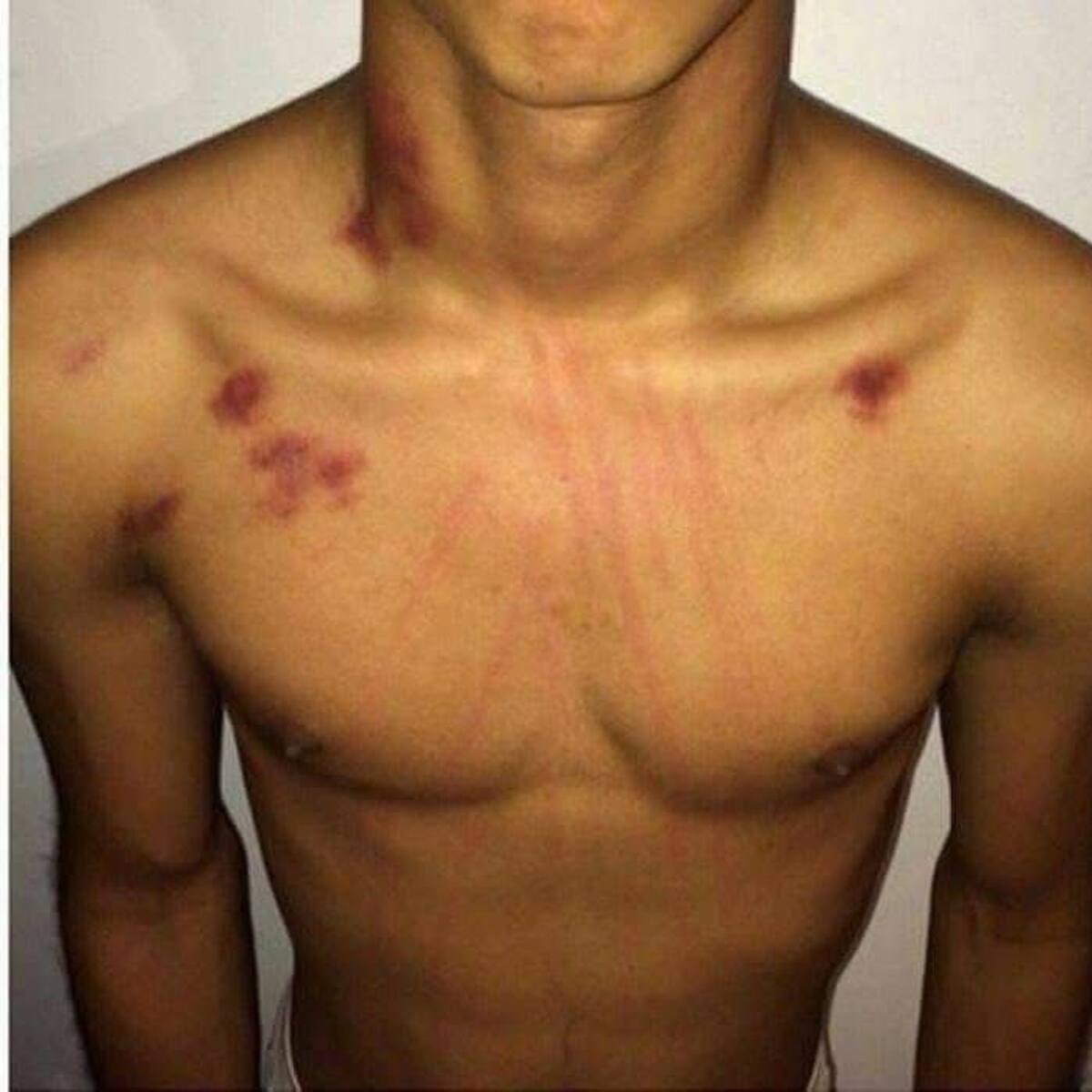 La misteriosa desaparición de hombres en Bolívar: tenían rasguños y moretones en su cuerpo