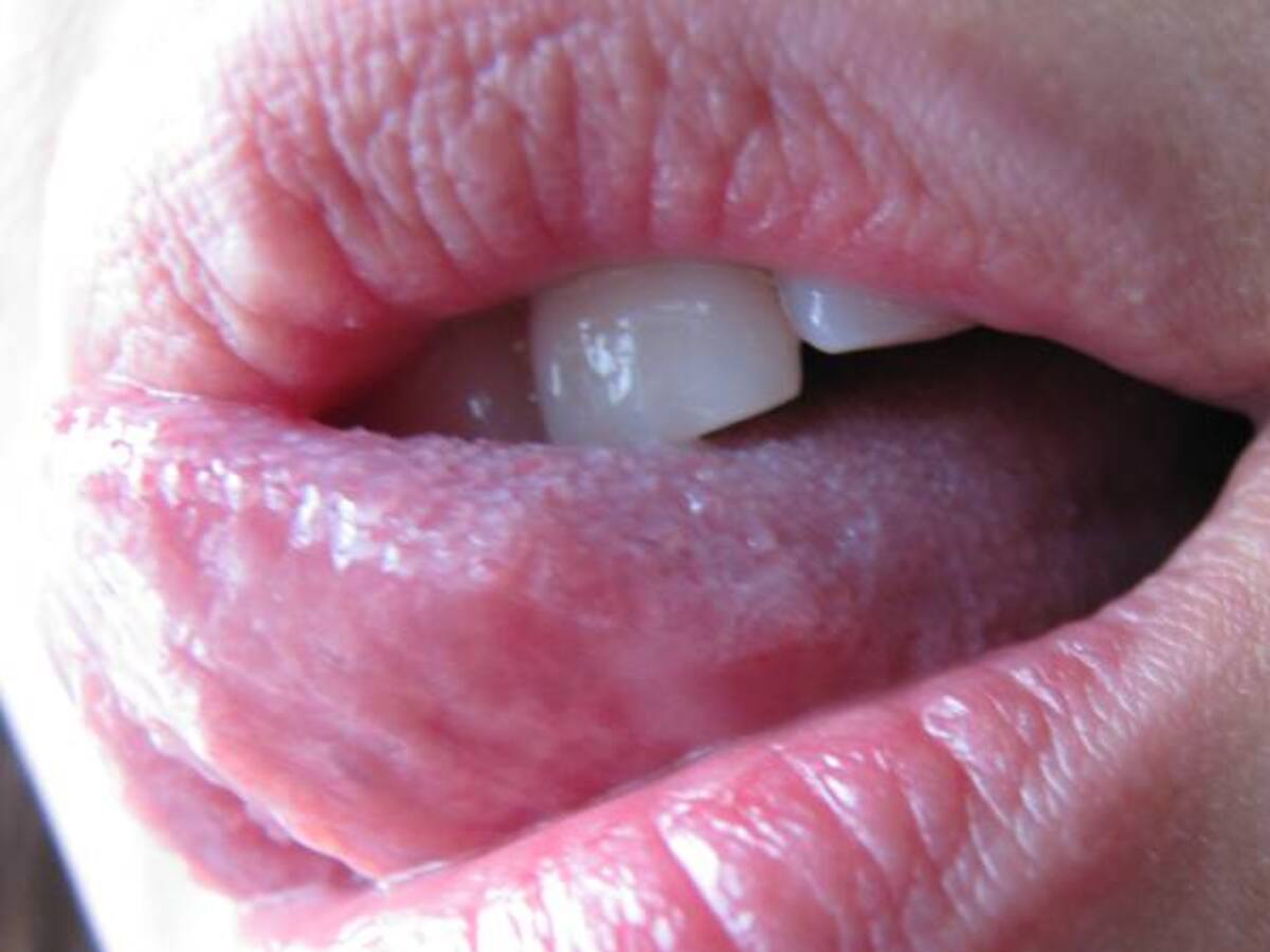 Japón desarrolla la primera prótesis de lengua