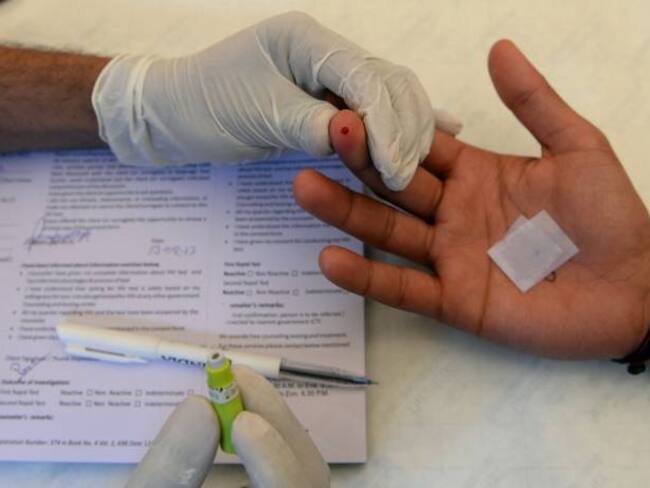 Acceso a tratamiento, reto para controlar VIH en Latinoamérica en 2030