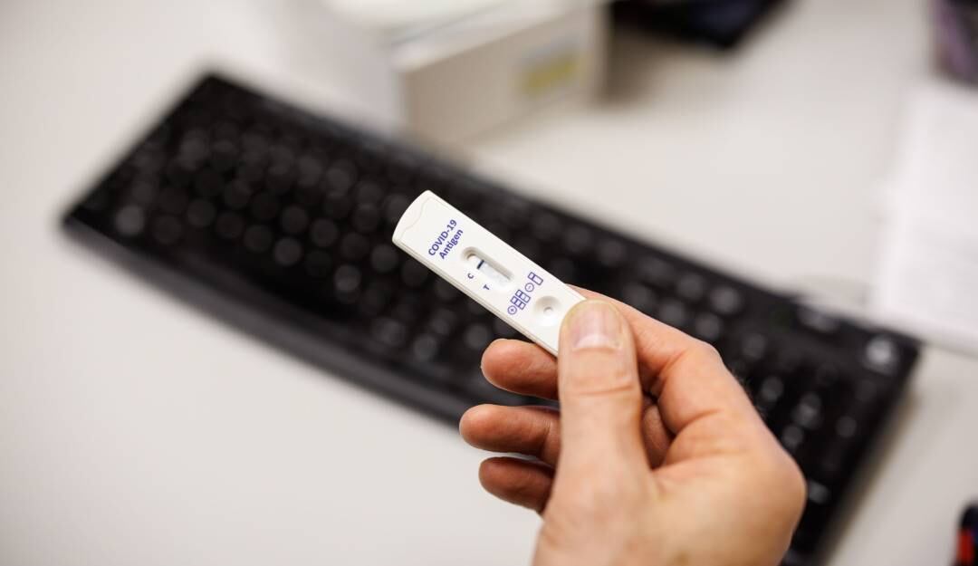 Prueba de antígenos.   Foto: Getty 