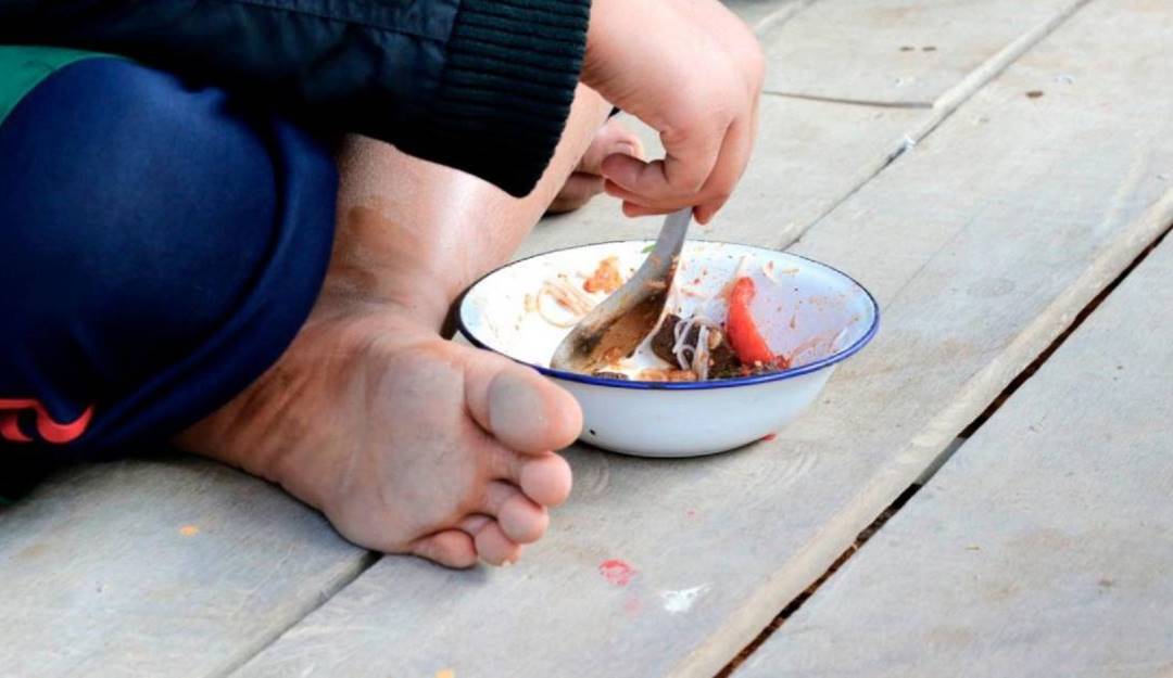 Foto: Archivo Desnutrición infantil 