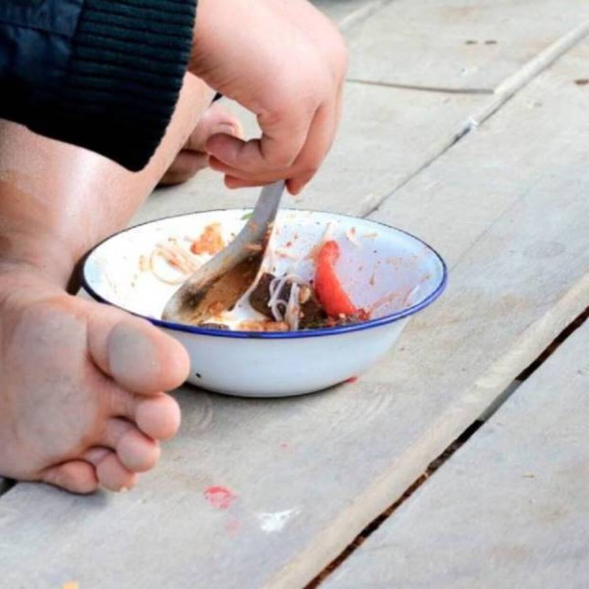 Veedurías advierten por aumento en casos de desnutrición infantil en La Guajira