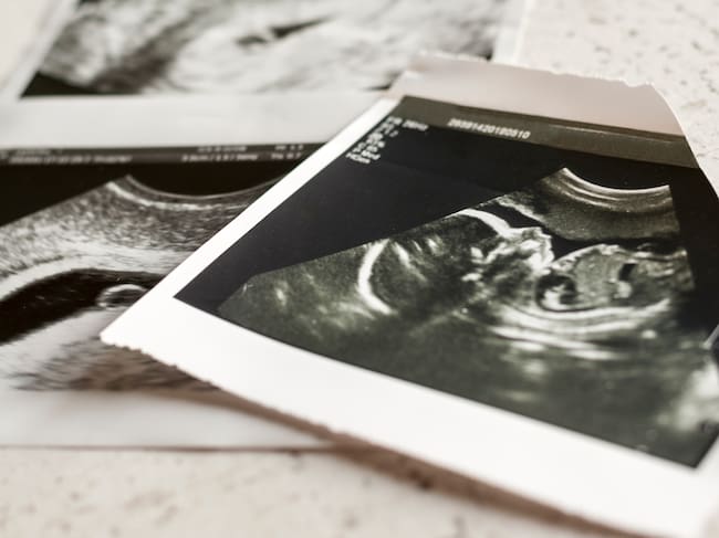 Mujer embarazada fue asesinada para robarle a su bebé en Soacha