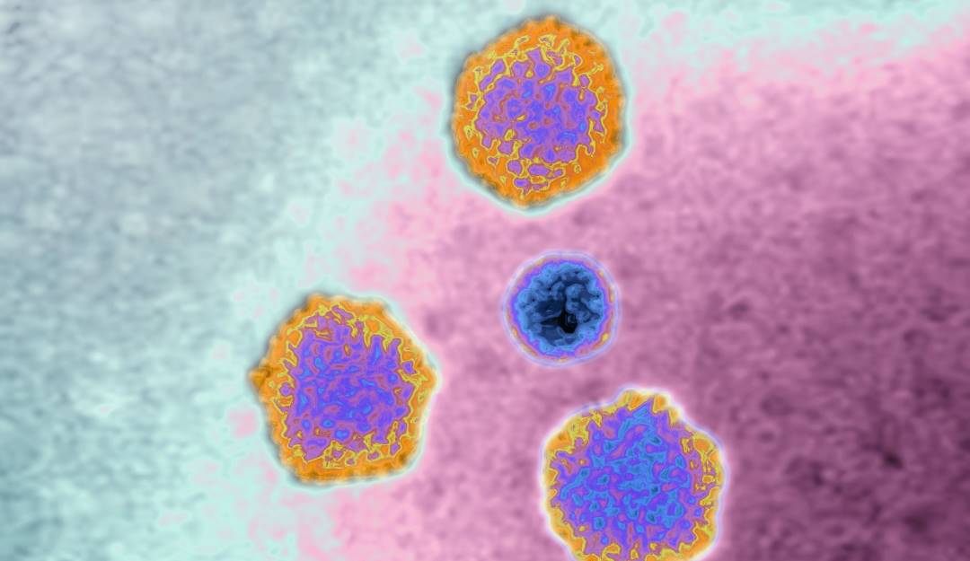 Adenovirus visto en un microscopio.                      Foto: Getty 