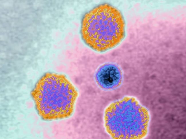 Adenovirus visto en un microscopio.                      Foto: Getty 