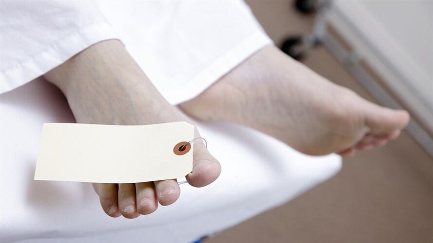 Fue encontrado el cuerpo sin vida de un modelo webcam en el barrio Las Nieves.