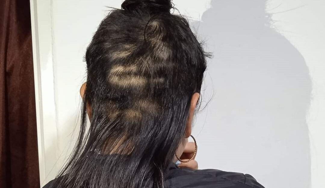 Adolescente de 17 años de edad fue víctima del hurto de gran parte de su cabello
