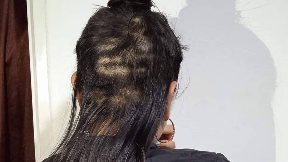 Denuncian que a una adolescente le hurtaron parte del cabello en Popayán