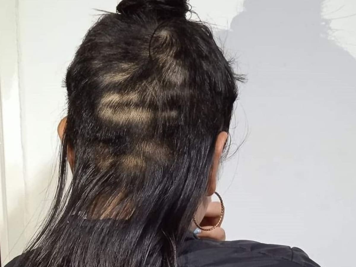 Denuncian que a una adolescente le hurtaron parte del cabello en Popayán