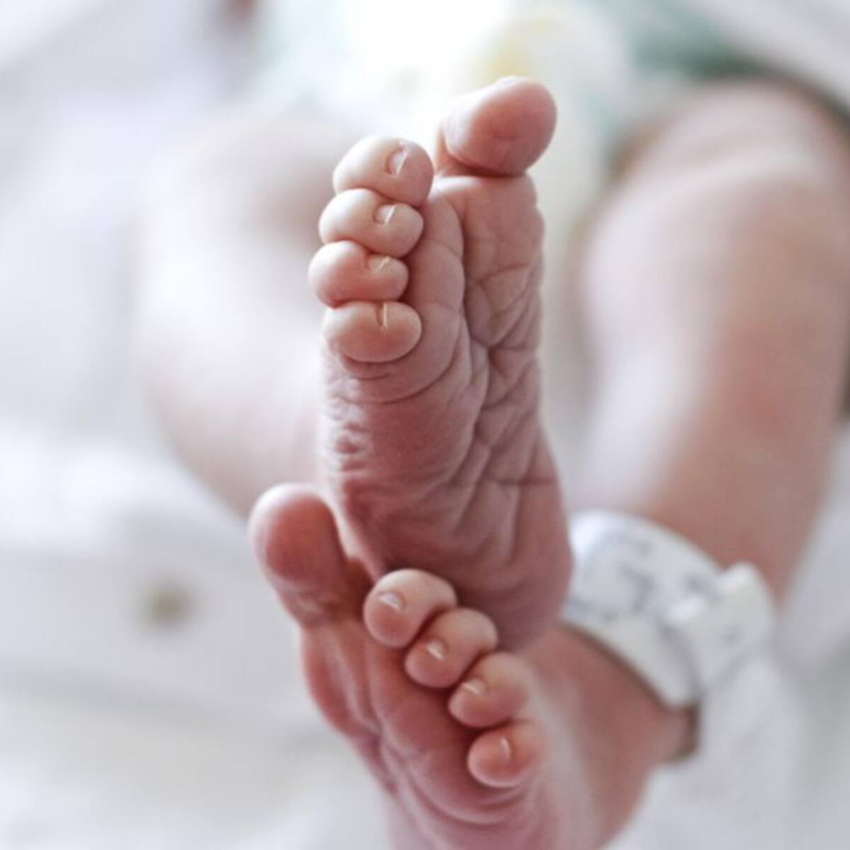 308 menores de cinco años murieron por desnutrición en 2022 en Colombia