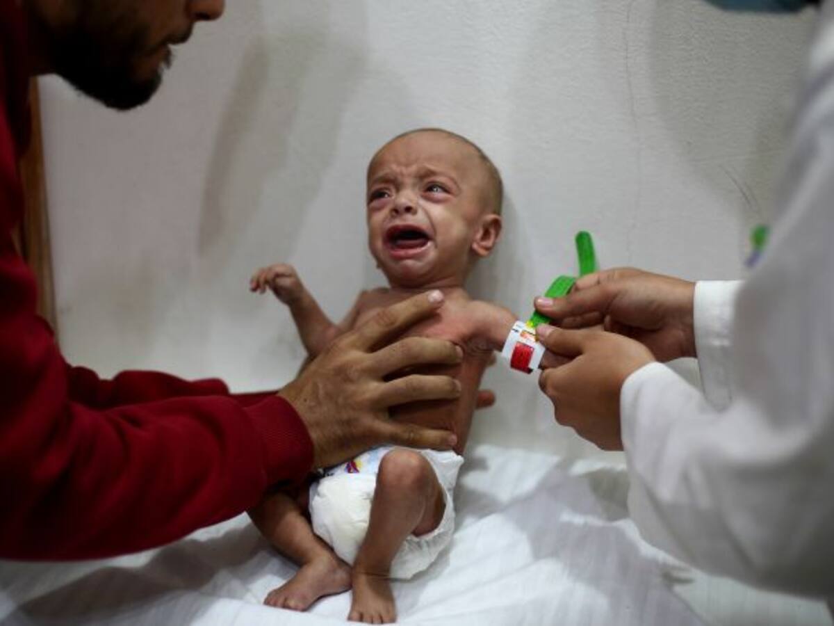 Desgarradoras imágenes muestran el hambre en Siria