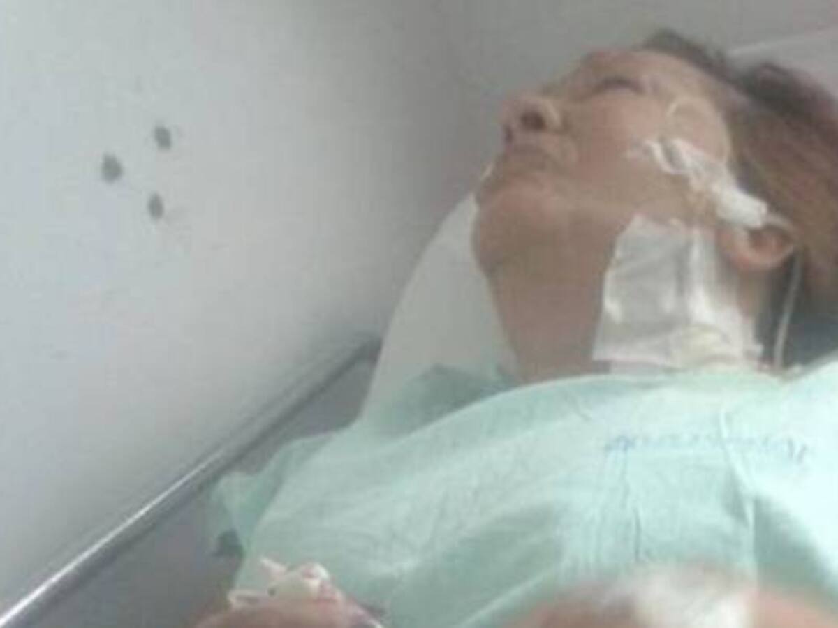 En grave estado de salud mujer atacada por un perro pit bull en Itagüí, Antioquia