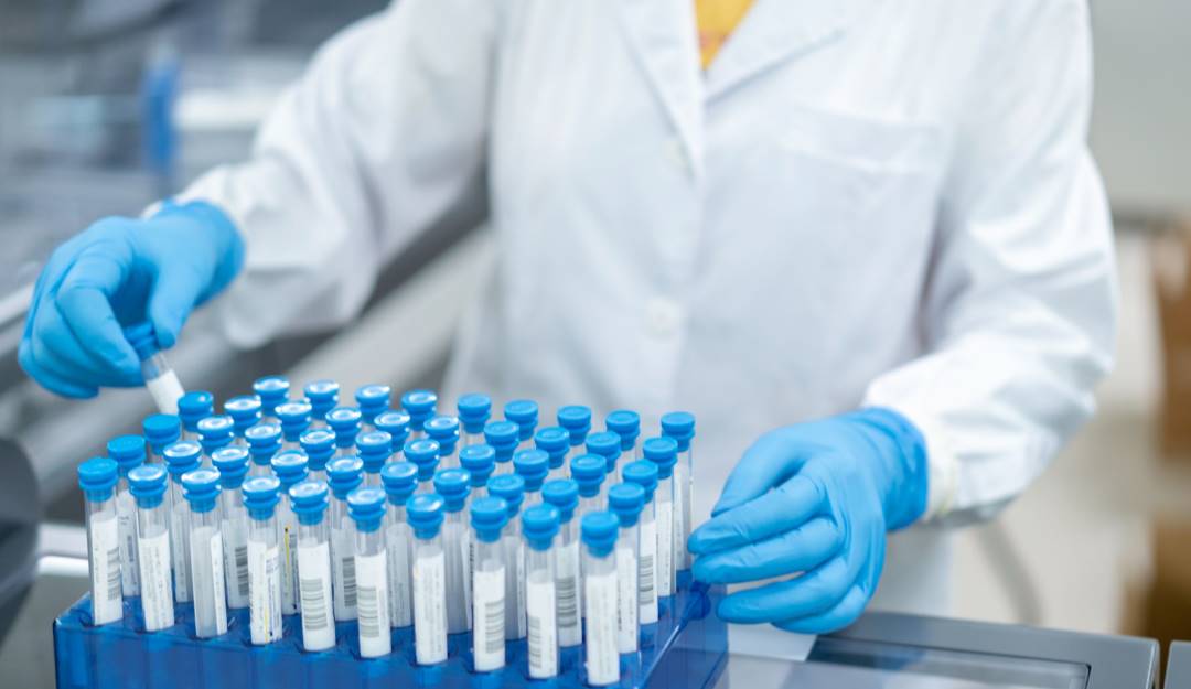 Nuevos casos de Viruela del Mono en Colombia. 