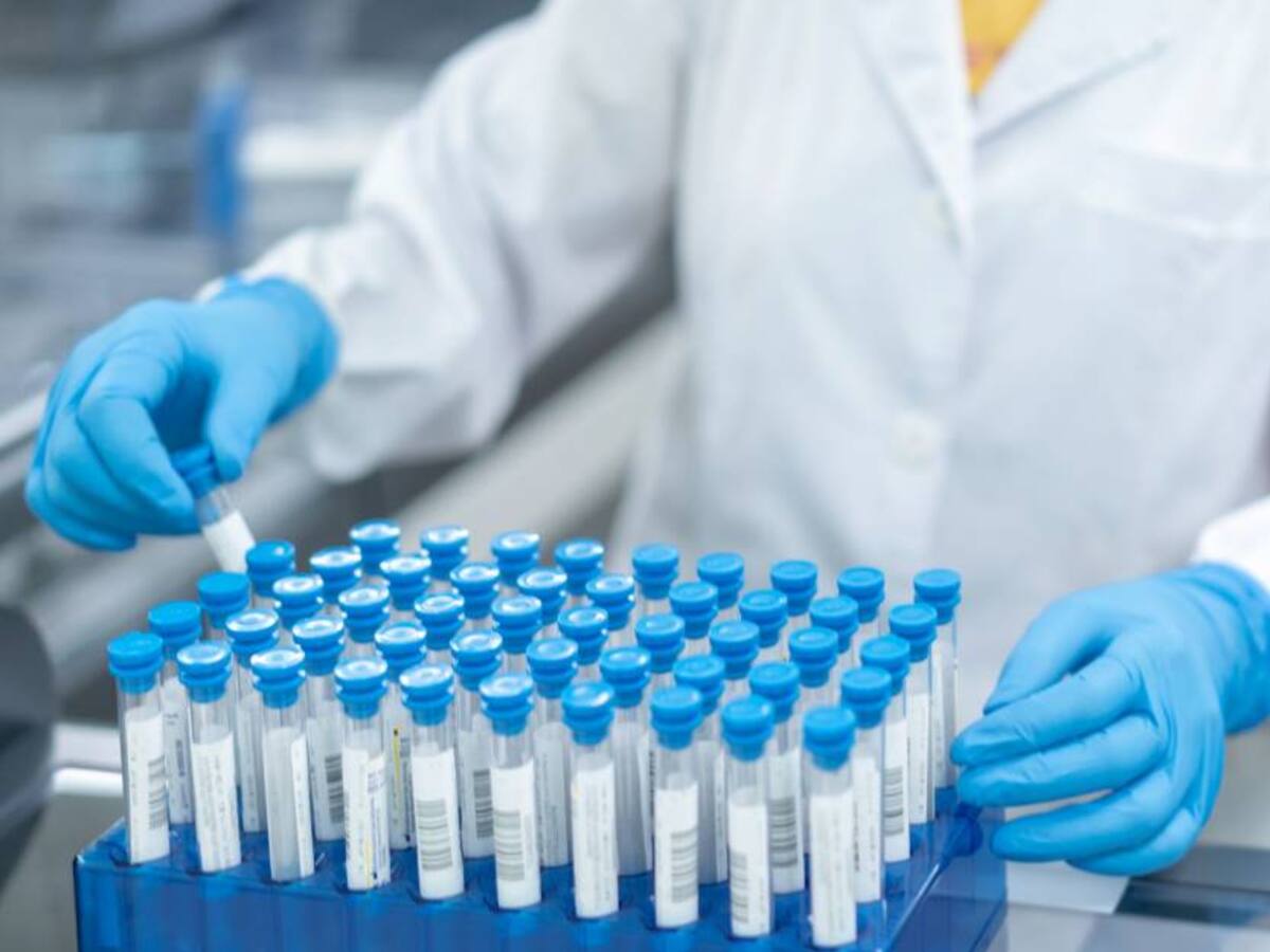 Aparecen nuevos casos de Viruela del Mono en Colombia