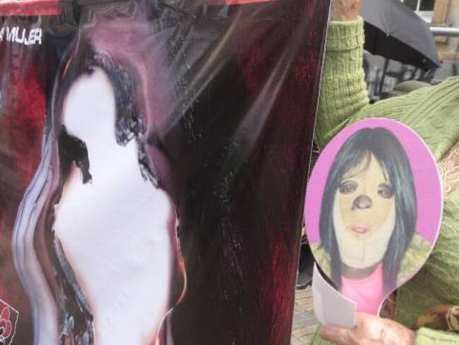 Informe Agresión ácido en Armenia