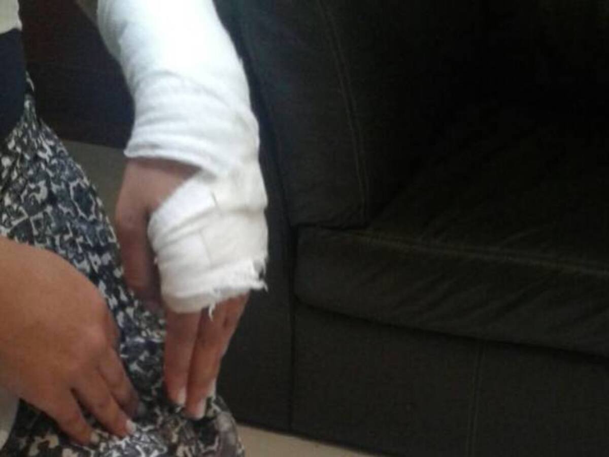 Con niño de 11 años aumenta a 41 la cifra de quemados en Antioquia