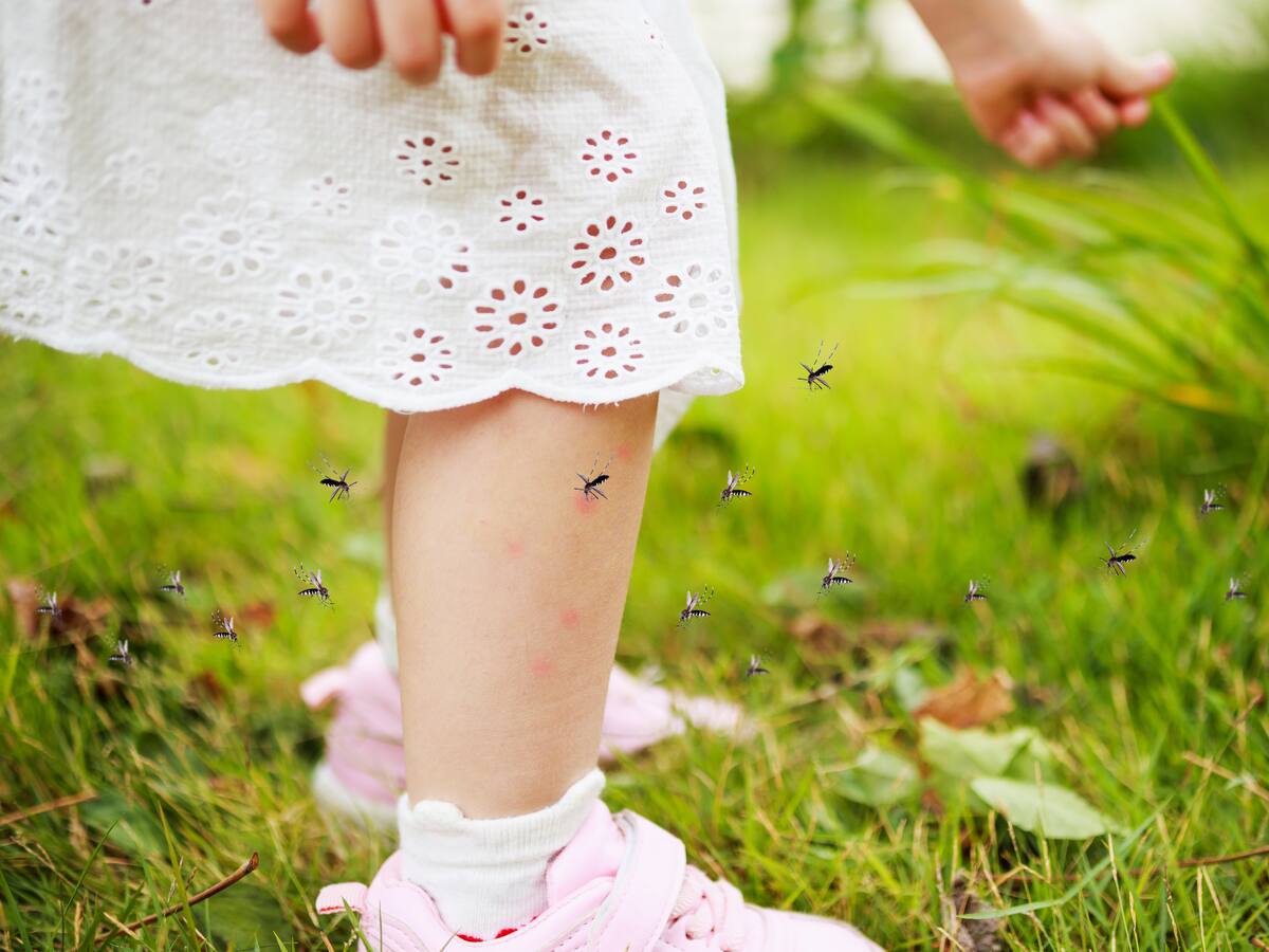 3 señales de que su hijo es alérgico a las picaduras de los mosquitos, según pediatra