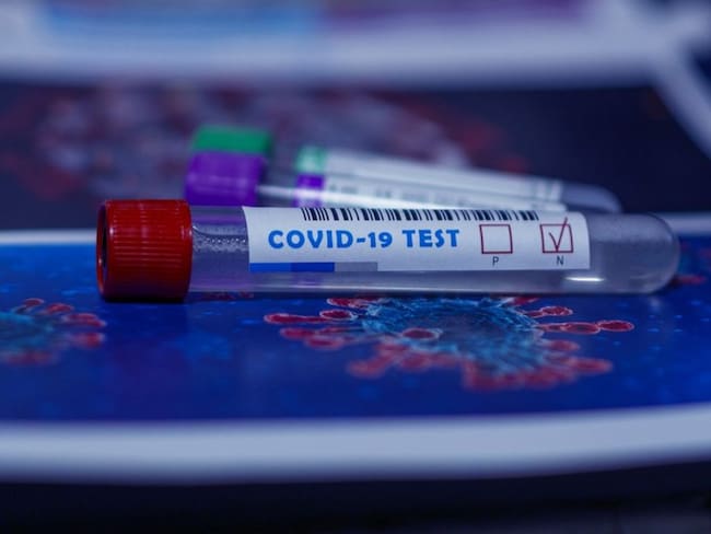 Vacuna de Oxford podría estar lista en septiembre tras pruebas masivas