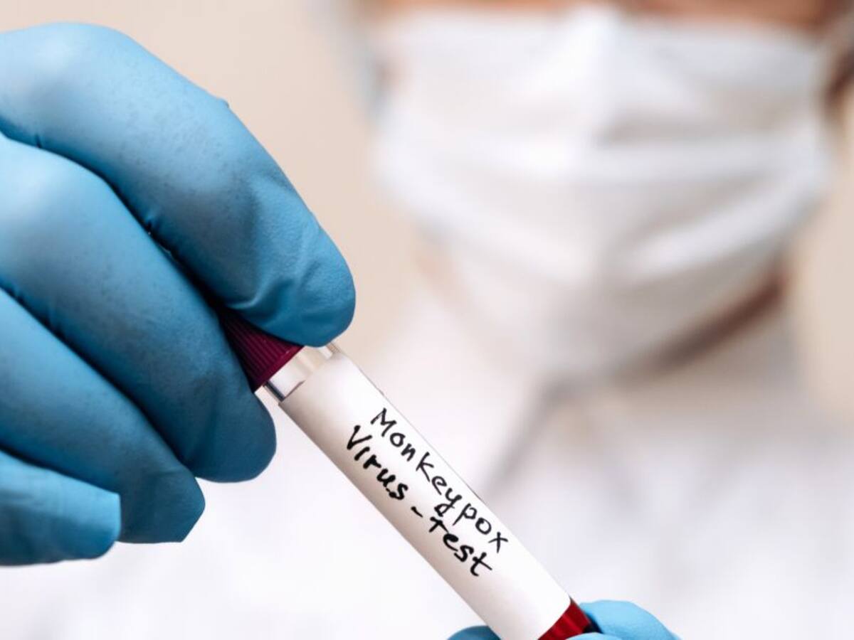 La OMS decidirá si declara alerta máxima el brote de viruela del mono