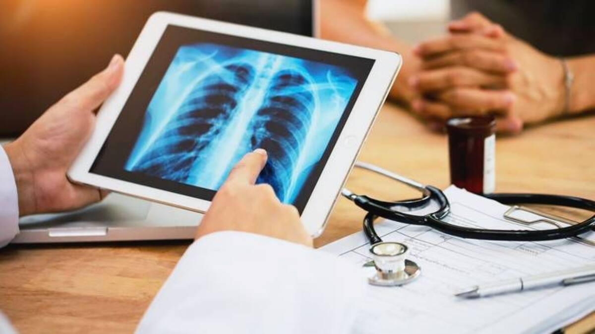 Autoridades de salud en Risaralda piden precaución por aumento de casos de tuberculosis