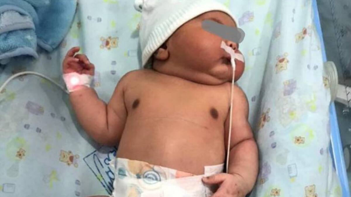 En Ciénaga, Magdalena, nació bebé gigante con un peso de 6.380 gramos