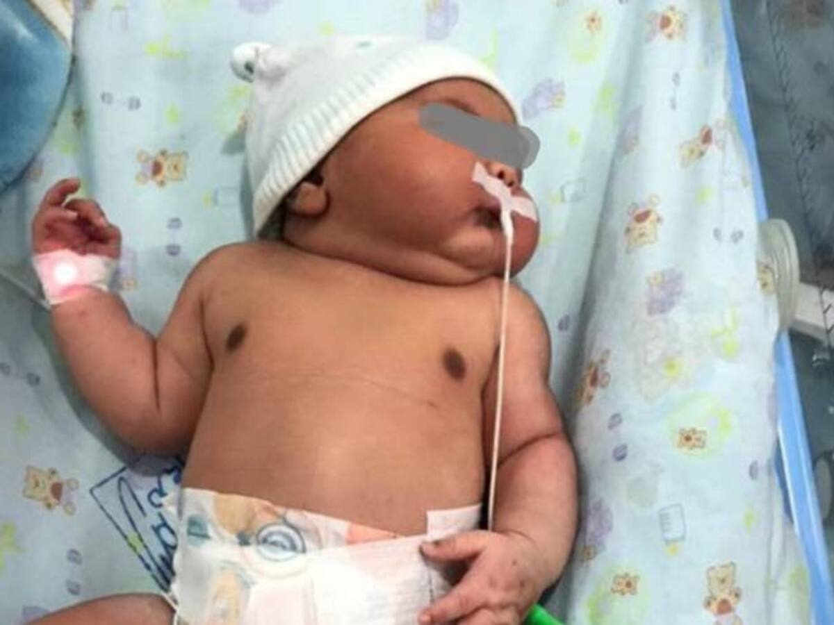 En Ciénaga, Magdalena, nació bebé gigante con un peso de 6.380 gramos