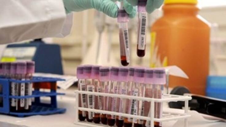 C Vale la vida, campaña para reducir la Hepatitis C.