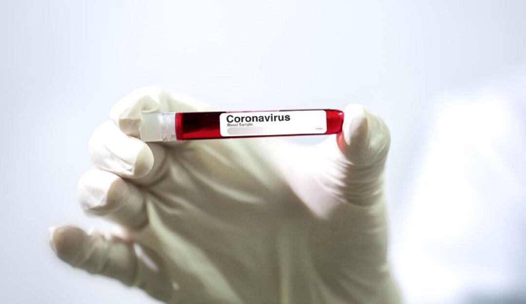 El Valle registra 321.651 contagiados y 10.012 fallecidos por el COVID-19.