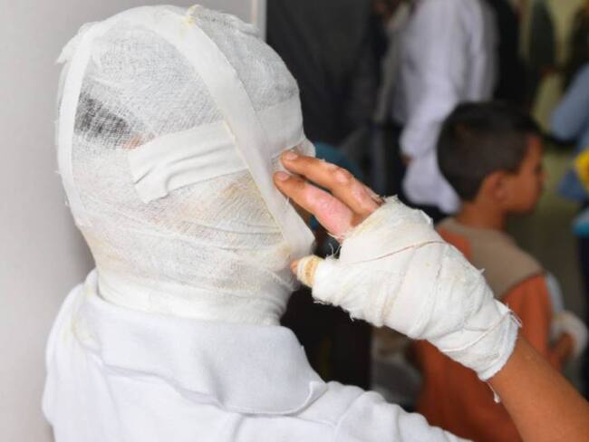 Santander alcanza récord en quemados con pólvora